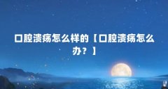 口腔溃疡怎么样的【口腔溃疡怎么办?】