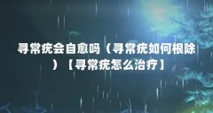 寻常疣会自愈吗(寻常疣如何根除)【寻常疣怎么治疗】