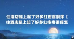 住酒店腿上起了好多红疙瘩很痒【住酒店腿上起了好多红疙瘩很痒怎么办】